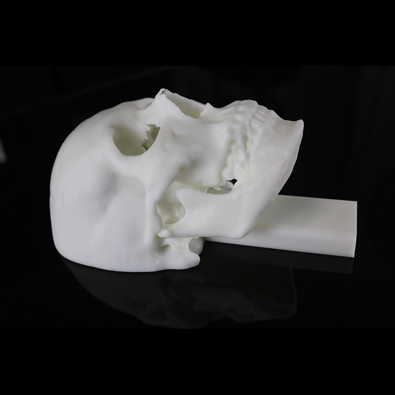 用於術前顱骨規劃的 SLA 3D 列印樹脂材料